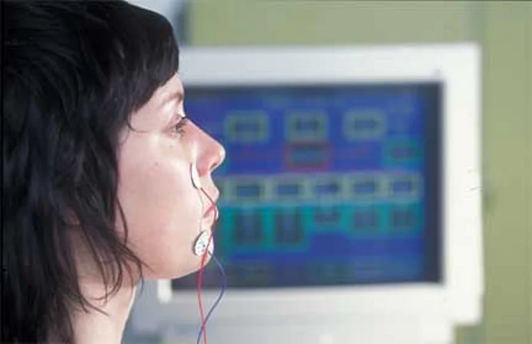 Patientin mit 2 Nadeln in Ober- und Unterlippe zur Ableitung des Fazialis-EMG´s des Mundastes